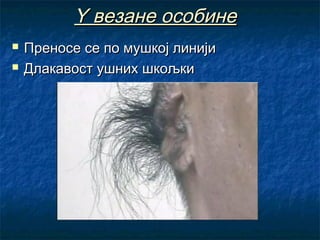 Y везане особине



Преносе се по мушкој линији
Длакавост ушних шкољки

 