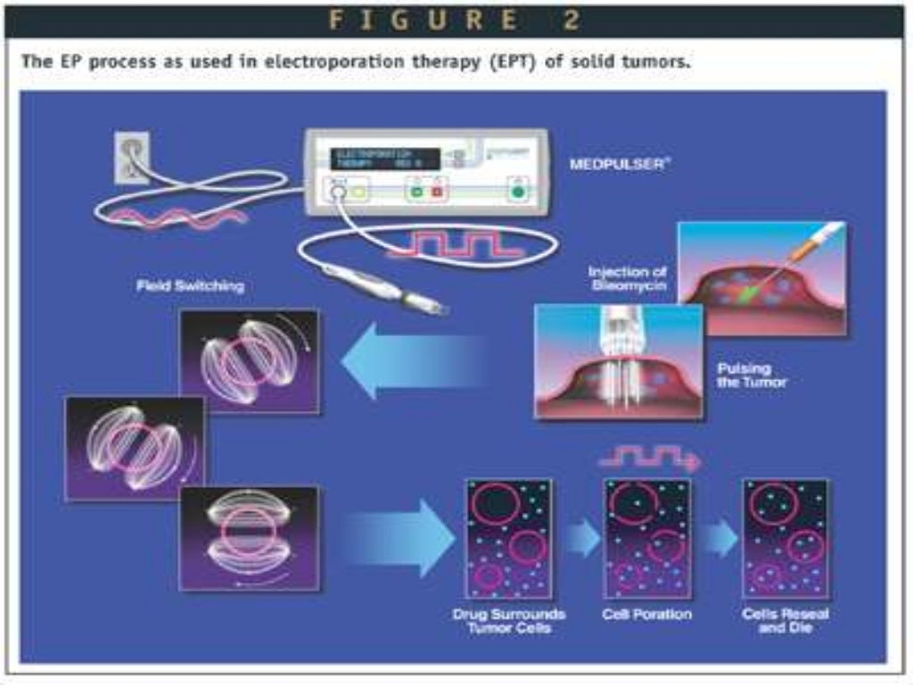 Gene Transfer By Physical Methods