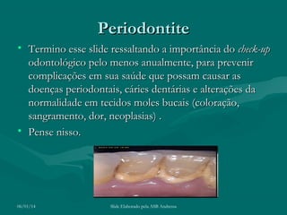 Periodontite
• Termino esse slide ressaltando a importância do check-up
odontológico pelo menos anualmente, para prevenir
complicações em sua saúde que possam causar as
doenças periodontais, cáries dentárias e alterações da
normalidade em tecidos moles bucais (coloração,
sangramento, dor, neoplasias) .
• Pense nisso.

06/01/14

Slide Elaborado pela ASB Andressa

 
