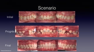 ©sylvainchamberland.com
World Tour
•Angle East meeting, Paris, Avril 2014
•AAO, 114th Annual Session,  
New Orleans, Avril...