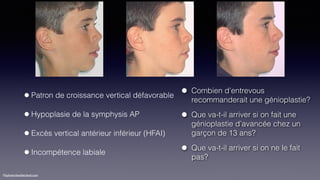 ©sylvainchamberland.com
Scenario
L.-P.Tr June 94
Initial
L.-P.Tr Jan 96, RPE HPHG, Intrusive arch
Progrès
L.-P.Tr June 97,...