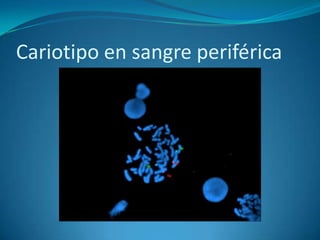 Cariotipo en sangre periférica
 
