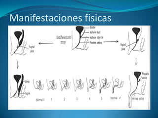 Manifestaciones fisicas
 