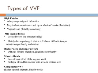 genital fisutlas very important topic in gynaecology | PPTX