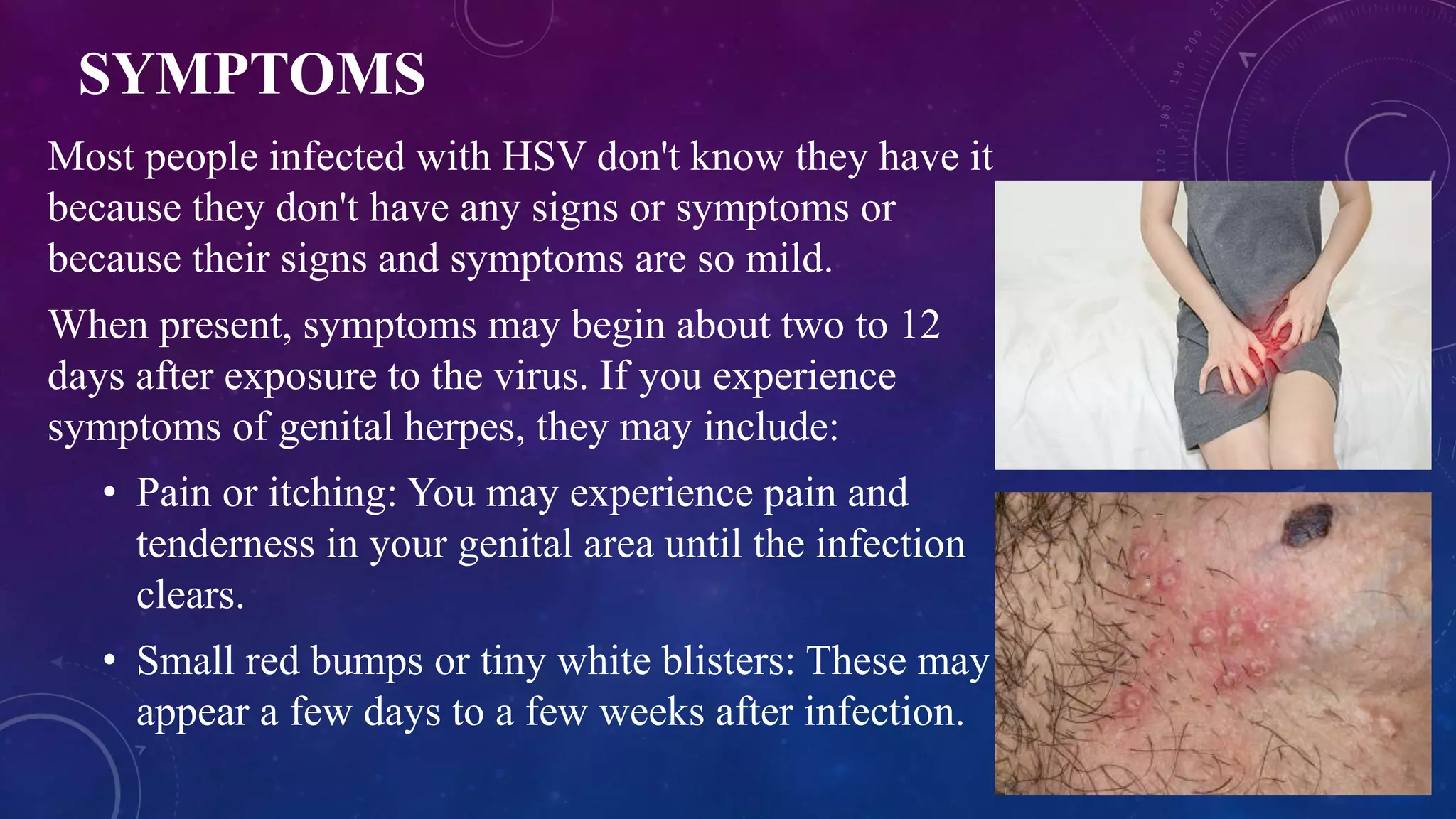 Genital Herpes Symptoms Diagnosis Treatment PPT