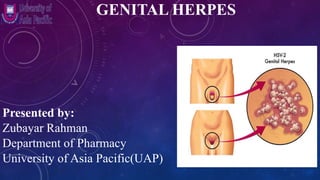 GENITAL HERPES
Presented by:
Zubayar Rahman
Department of Pharmacy
University of Asia Pacific(UAP)
 