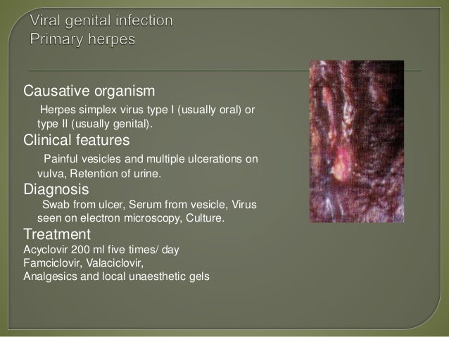 Can You Use Zpak To Treat Genital Herpes