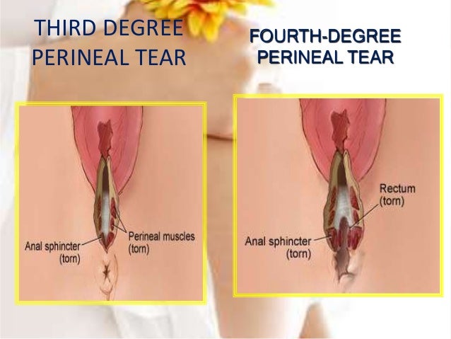Genital injuries obs nursing perineum anatomical diagram 