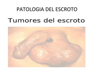 PATOLOGIA DEL ESCROTO
 