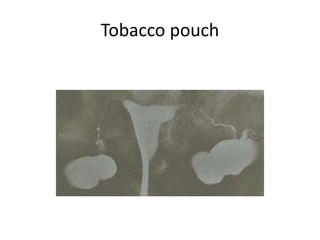 tobacco pouch appearance  MacQueen Pipes Tobacco pouches made of leather