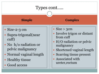 Simple Complex
 Size-2-3 cm
 Supra-trigonal(near
cuff)
 No h/o radiation or
pelvic malignancy
 Normal vaginal length
 Healthy tissue
 Good access
 Size > 3cm
 Involve trigon or distant
from cuff
 H/O radiation or pelvic
malignancy
 Shortened vaginal length
 Scarring tissue present
 Associated with
ureter,rectum
Types cont…..
 