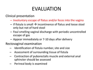 Genital tract fistulas main | PPTX
