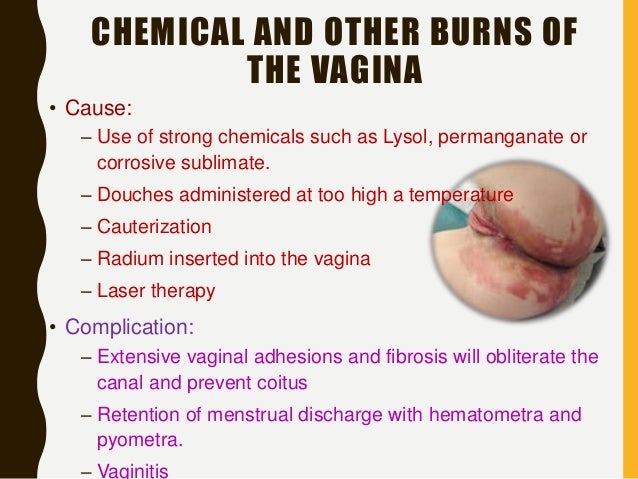 Genital tract injuries1