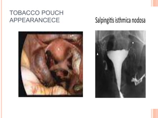 TOBACCO POUCH
APPEARANCECE
 