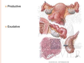  Productive
 Exudative
 