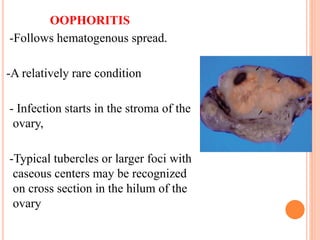 OOPHORITIS
-Follows hematogenous spread.
-A relatively rare condition
- Infection starts in the stroma of the
ovary,
-Typical tubercles or larger foci with
caseous centers may be recognized
on cross section in the hilum of the
ovary
 