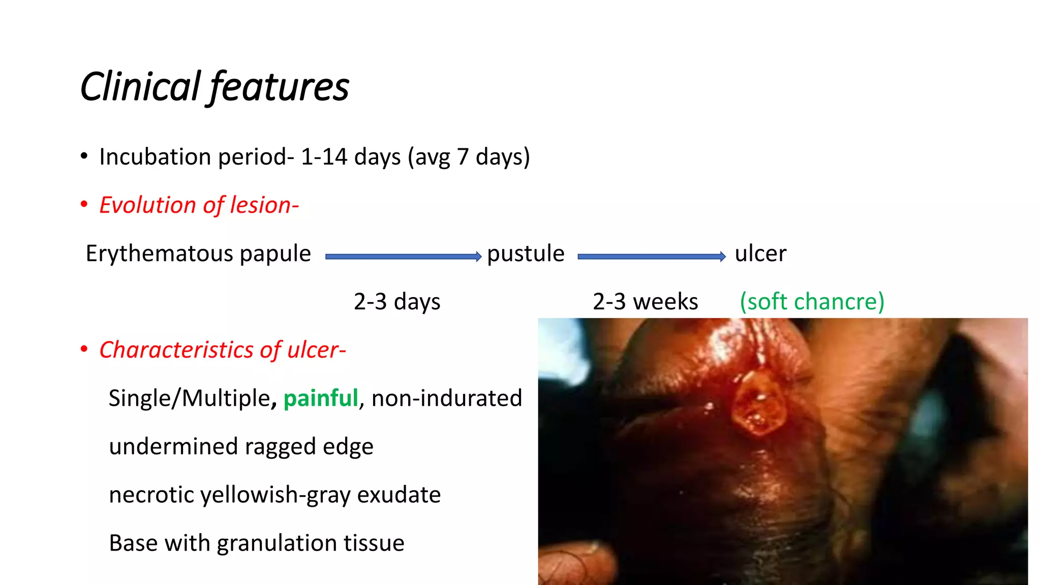 genital ulcer.pptx