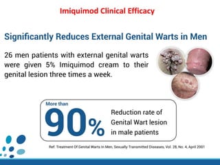 Imiquimod Clinical Efficacy
 