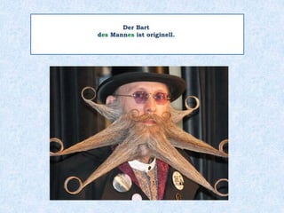 Der Bart
d___ Mann___ ist originell.es es
 