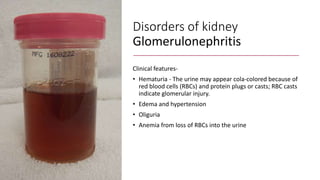 Disorders of kidney
Glomerulonephritis
Clinical features-
• Hematuria - The urine may appear cola-colored because of
red blood cells (RBCs) and protein plugs or casts; RBC casts
indicate glomerular injury.
• Edema and hypertension
• Oliguria
• Anemia from loss of RBCs into the urine
 