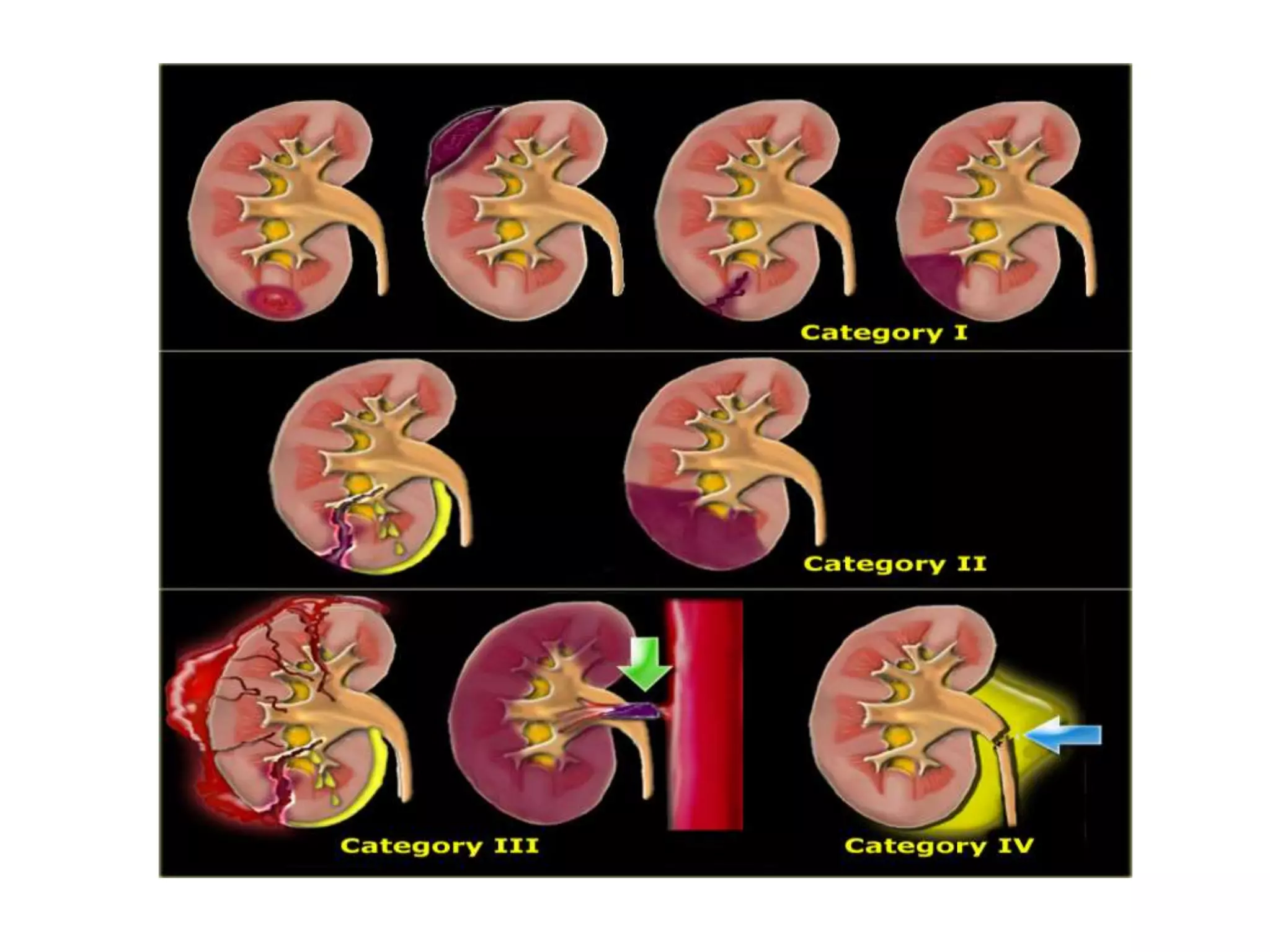 Genito-urinary trauma | PPT