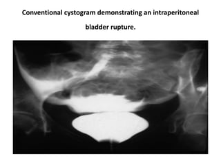 Genito-urinary trauma | PPT