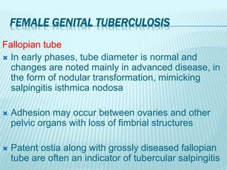 FEMALE GENITAL TUBERCULOSIS
Fallopian tube
 In early phases, tube diameter is normal and
changes are noted mainly in advanced disease, in
the form of nodular transformation, mimicking
salpingitis isthmica nodosa
 Adhesion may occur between ovaries and other
pelvic organs with loss of fimbrial structures
 Patent ostia along with grossly diseased fallopian
tube are often an indicator of tubercular salpingitis
 