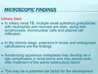 MICROSCOPIC FINDINGS
Urinary tract:
 In miliary renal TB, multiple small epitheloid granulomas
with neutrophils and necrosis are seen, along with
lymphocytes, mononuclear cells and plasma cell
infiltration
 In the chronic stage, extensive Þ brosis and widespread
calcifications are the findings
 Keratinizing squamous metaplasia may develop as a
late complication in renal pelvis and may persist even
after treatment of the active tuberculous lesion
 This may be a potential risk factor for the development
 