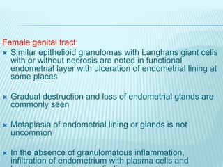 Female genital tract:
 Similar epithelioid granulomas with Langhans giant cells
with or without necrosis are noted in fun...