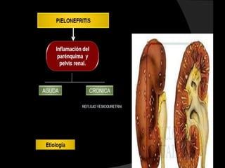 Difteria-tos ferina-   Primera     Difteria-tos ferina-
    tetanos (DPT)                          tetanos


Haemoplylus influenzae   Primera      Meningitis u otras
       tipo B                      enfermedades causadas
                                      po H. influenzae


      Hepatitis   B      Primera         Hepatitis   B

   Vacuna oral de        Primera
    polio (VOP)                        Poliomielitis


    Vacuna oral de
                         Primera
                                         Rotavirus
       rotavirus


   Vacuna contra el                   Neumonia-otitis-
     pneumococo          Primera        meningitis
 