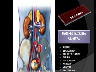 Difteria-tos ferina-
                         Segunda     Difteria-tos
    tetanos (DPT)
                                    ferina-tetanos
Haemoplylus influenzae                Meningitis u otras
       tipo B            Segunda   enfermedades causadas
                                      por H. influenzae


     Hepatitis   B       Segunda     Hepatitis B

   Vacuna oral de
    polio (VOP)
                         Segunda     Poliomielitis

    Vacuna oral de       Segunda       Rotavirus
       rotavirus


   Vacuna contra el      Segunda   Neumonia-otitis-
     pneumococo
                                     meningitis
 
