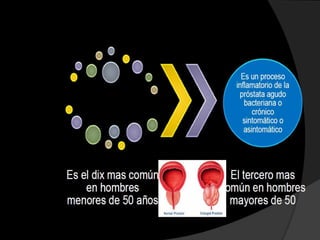 Difteria-tos              Difteria-tos
                 Primer
   ferina-                   ferina-
                refuerzo
tetanos (DPT)                tetanos

 Vacuna oral
   de polio      Primer
                           Poliomielitis
                refuerzo
    (VOP)
 