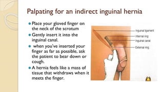 Palpating for an indirect inguinal hernia
⚫ Place your gloved finger on
the neck of the scrotum
⚫ Gently insert it into the
inguinal canal.
⚫ when you’ve inserted your
finger as far as possible, ask
the patient to bear down or
cough.
⚫ A hernia feels like a mass of
tissue that withdraws when it
meets the finger.
 