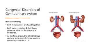 GENITO URINARY DISORDERS-2.pptx