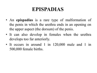 EPISPADIAS
• An epispadias is a rare type of malformation of
the penis in which the urethra ends in an opening on
the upper aspect (the dorsum) of the penis.
• It can also develop in females when the urethra
develops too far anteriorly.
• It occurs in around 1 in 120,000 male and 1 in
500,000 female births.
 