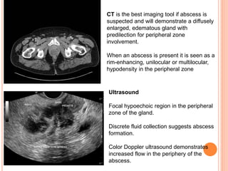 genitourinary infection radiology.pptx