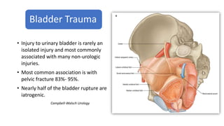 Trauma to Urinary Tract/ Urinary Tract Injury | PPTX