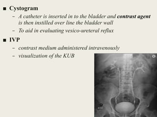 ■ Cystogram
– A catheter is inserted in to the bladder and contrast agent
is then instilled over line the bladder wall
– To aid in evaluating vesico-ureteral reflux
■ IVP
– contrast medium administered intravenously
– visualization of the KUB
15
 
