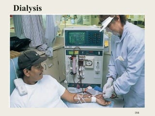 Dialysis
184
 