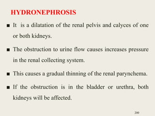 HYDRONEPHROSIS
■ It is a dilatation of the renal pelvis and calyces of one
or both kidneys.
■ The obstruction to urine flow causes increases pressure
in the renal collecting system.
■ This causes a gradual thinning of the renal parynchema.
■ If the obstruction is in the bladder or urethra, both
kidneys will be affected.
200
 