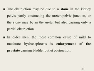 ■ The obstruction may be due to a stone in the kidney
pelvis partly obstructing the ureteropelvic junction, or
the stone may be in the ureter but also causing only a
partial obstruction.
■ In older men, the most common cause of mild to
moderate hydronephrosis is enlargement of the
prostate causing bladder outlet obstruction.
201
 