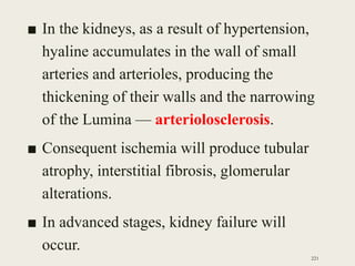 ■ In the kidneys, as a result of hypertension,
hyaline accumulates in the wall of small
arteries and arterioles, producing the
thickening of their walls and the narrowing
of the Lumina — arteriolosclerosis.
■ Consequent ischemia will produce tubular
atrophy, interstitial fibrosis, glomerular
alterations.
■ In advanced stages, kidney failure will
occur.
221
 