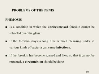 PROBLEMS OF THE PENIS
PHIMOSIS
■ Is a condition in which the uncircumcised foreskin cannot be
retracted over the glans.
■ If the foreskin stays a long time without cleansing under it,
various kinds of bacteria can cause infections.
■ If the foreskin has become scarred and fixed so that it cannot be
retracted, a circumcision should be done.
234
 