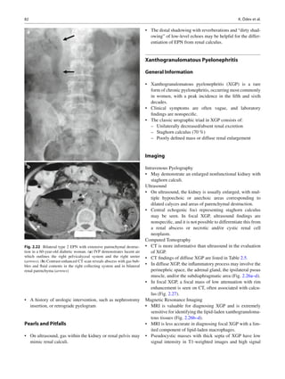 Xgp Radiology Genitourinary radiology kidney, bladder and urethra | PDF