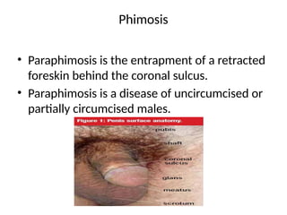 genito urinary system.pathophysiologpptx | PPTX