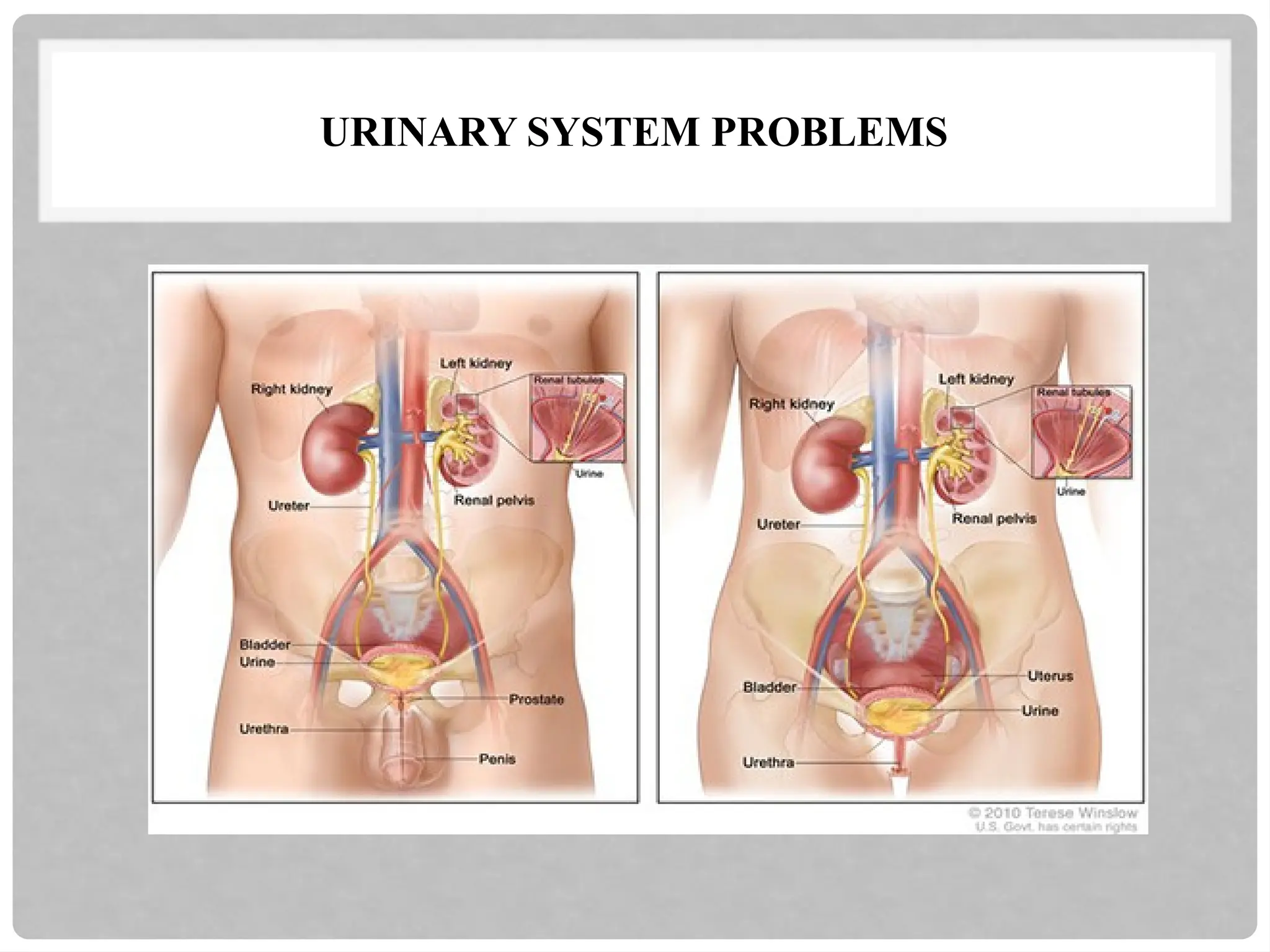 URINARY SYSTEM PROBLEMS
 