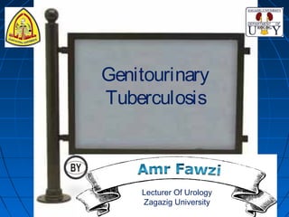 Genitourinary
Tuberculosis
Lecturer Of Urology
Zagazig University
 