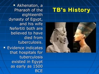  Akhenaton, aAkhenaton, a
Pharaoh of thePharaoh of the
eighteentheighteenth
dynasty of Egypt,dynasty of Egypt,
and his wifeand his wife
Nefertiti both areNefertiti both are
believed to havebelieved to have
died fromdied from
tuberculosis.tuberculosis.
 Evidence indicatesEvidence indicates
that hospitals forthat hospitals for
tuberculosistuberculosis
existed in Egyptexisted in Egypt
as early as 1500as early as 1500
BCEBCE
TB's History
 