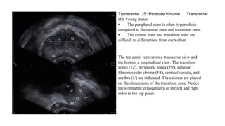 Genitourinary Tract Male and Female imaging.pptx