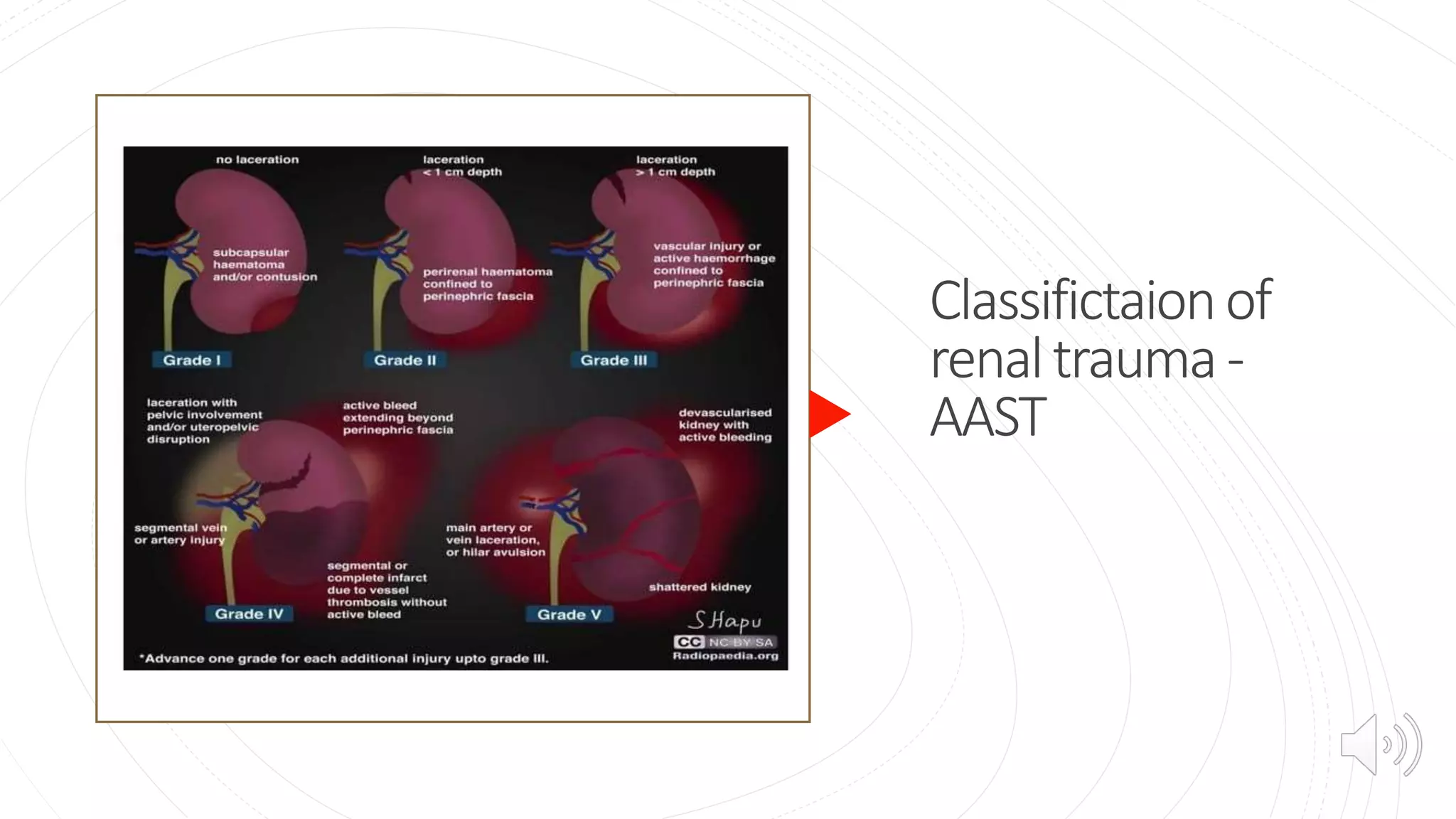genitourinary trauma.pptx